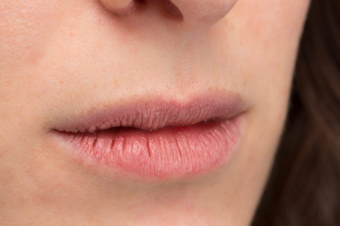 chronic illness causing dry lips and dry eyes