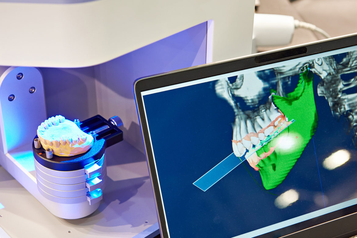 3D printing of dentures 3D printing of dentures