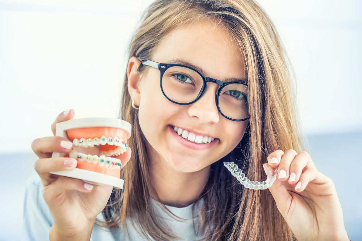 invisalign vs braces
