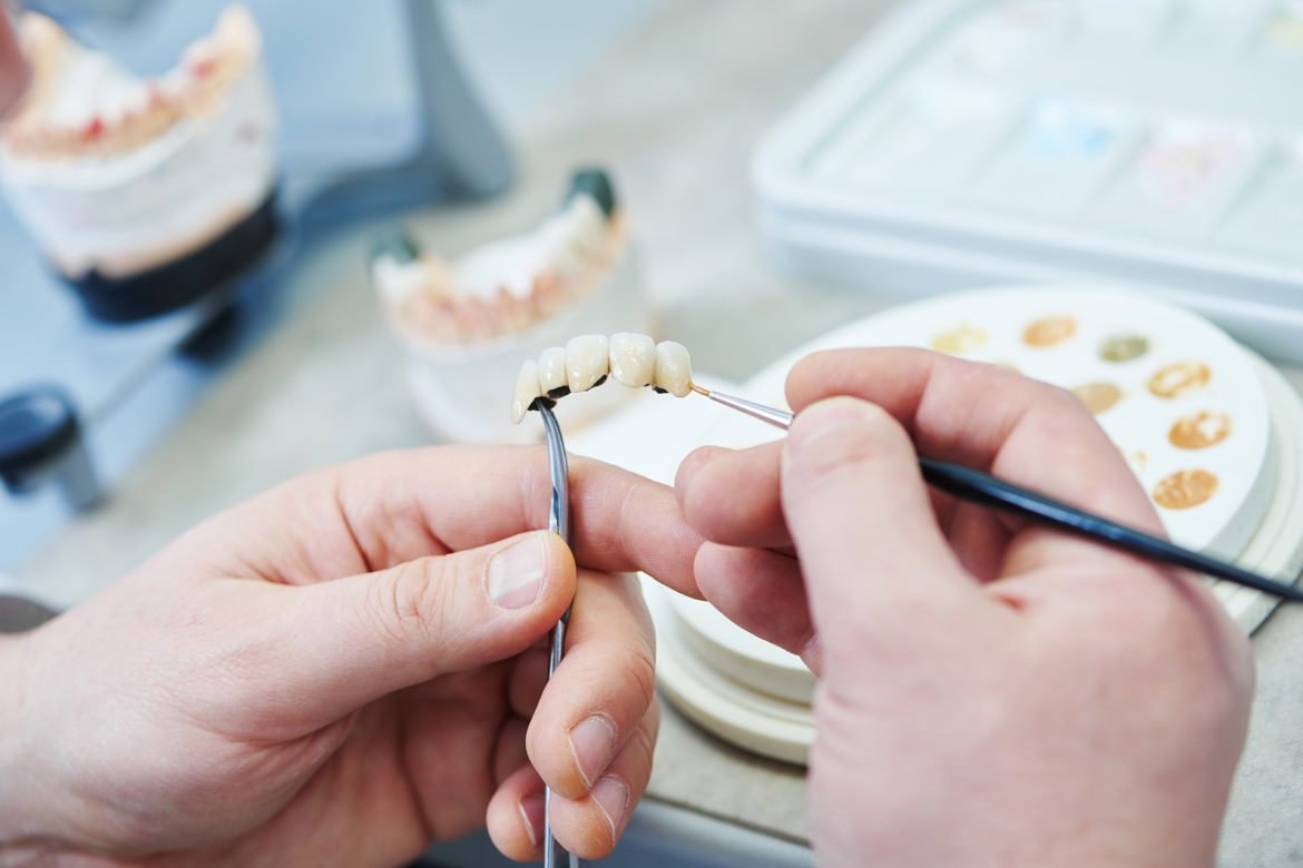 designing replacement teeth designing replacement teeth