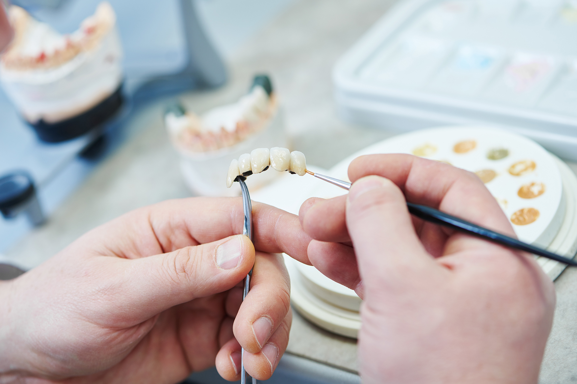 designing replacement teeth