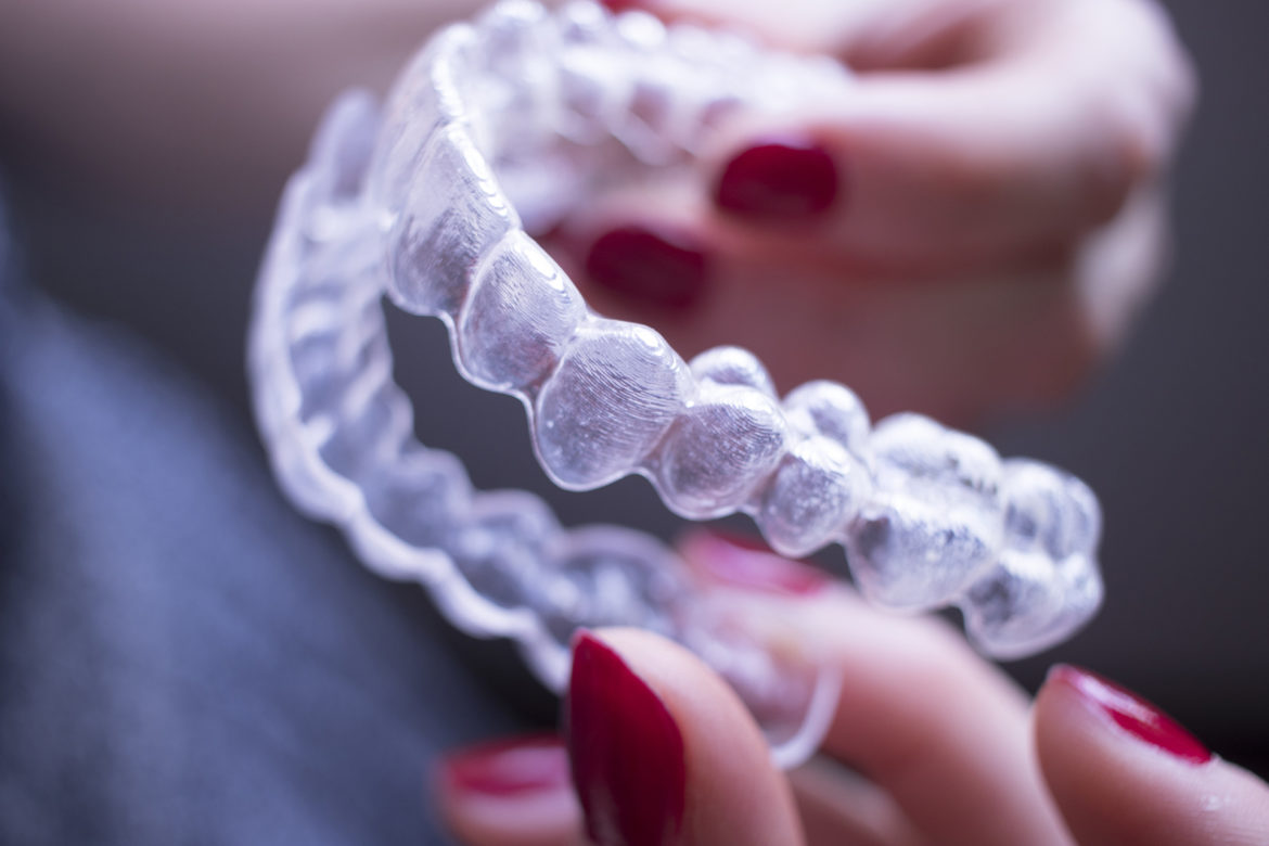 insivible-dental-alignments insivible-dental-alignments