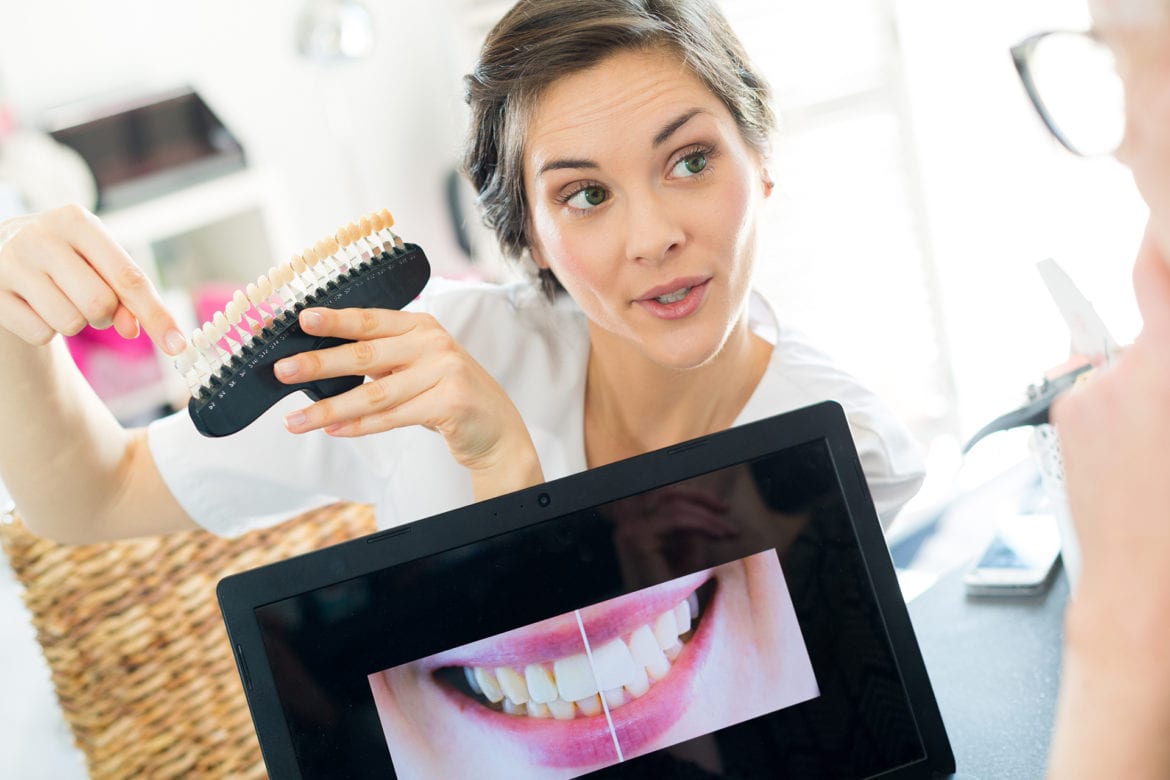 blog-eds-whatRvenners Veneer-size demonstration with a female dentist