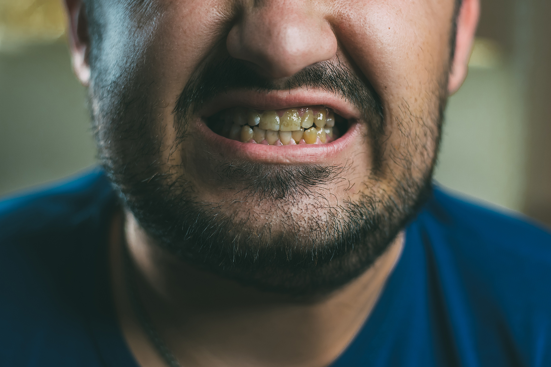 man with yellow teeth