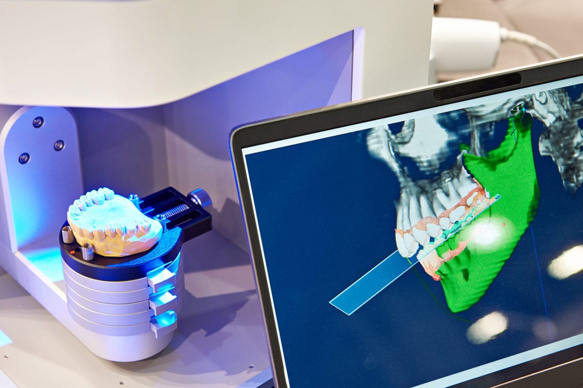 teeth 3d print