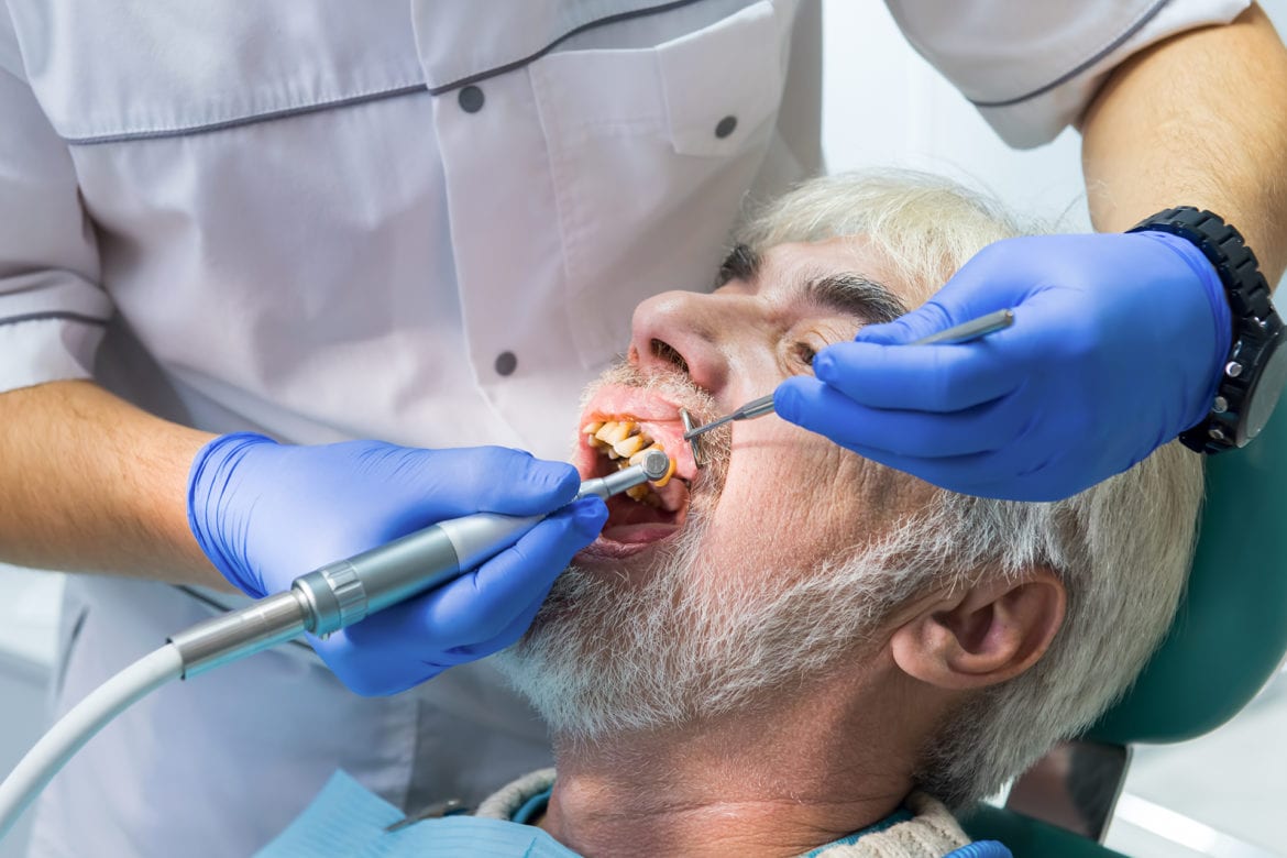 blog-eds-yellowteeth dentist cleaning yellow teeth