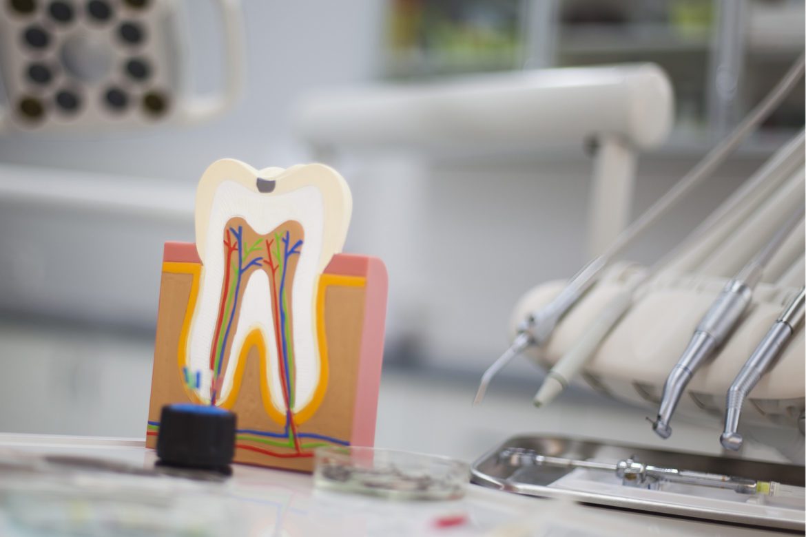 tooth model in the dentist's office