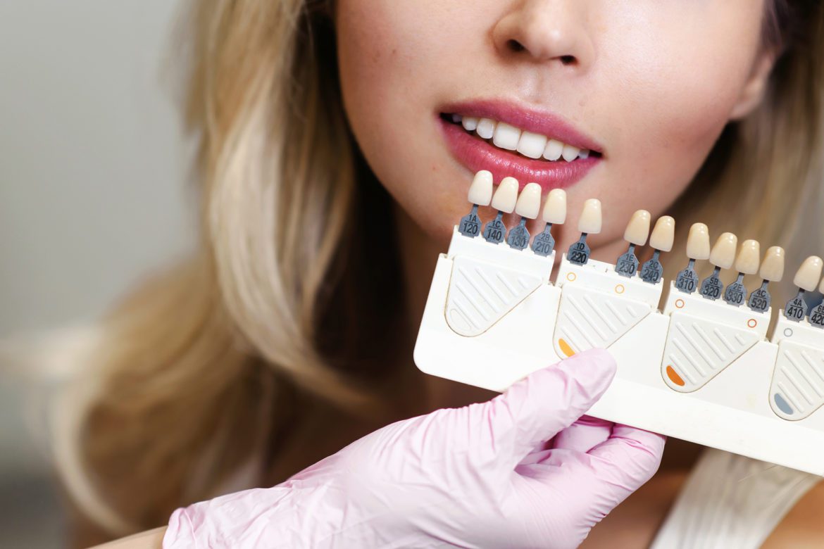 blog-eds-vennerRisk woman being fitted for veneers