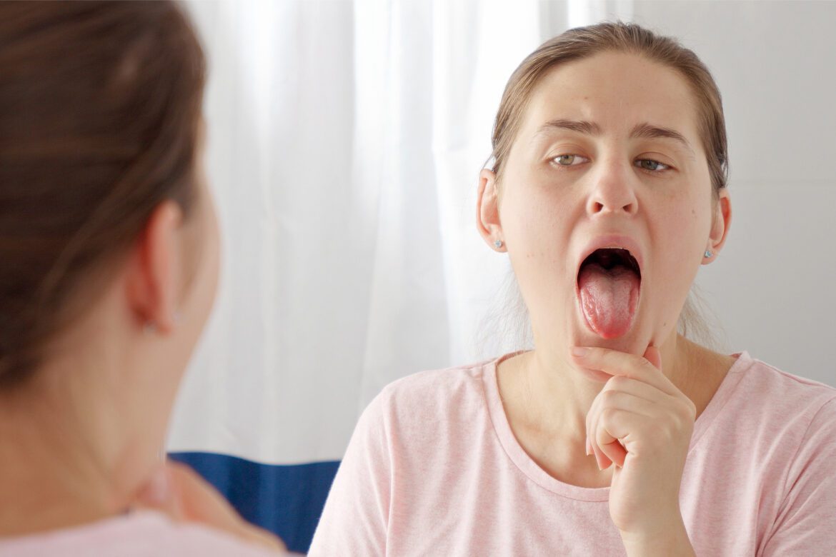 blog-eds-mouthNvascular Woman examining her tongue